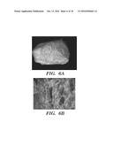 HIGH STRENGTH CHITIN COMPOSITE MATERIAL AND METHOD OF MAKING diagram and image