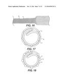 EXPANDABLE SHEATH diagram and image