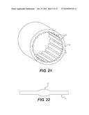 EXPANDABLE SHEATH diagram and image