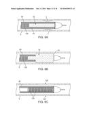 ADJUSTABLE-LENGTH DRUG DELIVERY BALLOON diagram and image