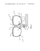 METHOD FOR SEPARATING DUAL WHEELS diagram and image