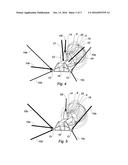 ADJUSTABLE ENGINE SUSPENSION FOR POSITIONING THE ENGINE RELATIVE TO THE     MOUNT THEREOF diagram and image