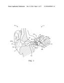 ANATOMICALLY CUSTOMIZED EAR CANAL HEARING APPARATUS diagram and image