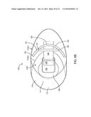 ANATOMICALLY CUSTOMIZED EAR CANAL HEARING APPARATUS diagram and image