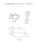 ANATOMICALLY CUSTOMIZED EAR CANAL HEARING APPARATUS diagram and image