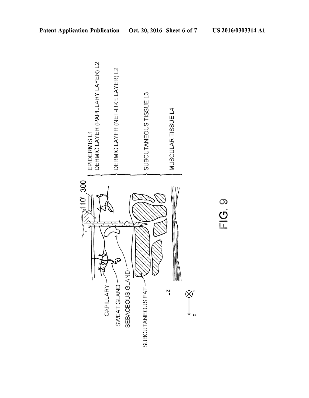 INJECTION NEEDLE UNIT AND LIQUID INJECTION DEVICE - diagram, schematic, and image 07