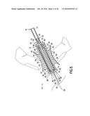 Passively Shielding Needle Device diagram and image