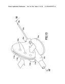 Passively Shielding Needle Device diagram and image