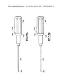 Passively Shielding Needle Device diagram and image