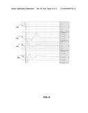 CONTROLLING ELECTRICAL STIMULATION BASED ON EVOKED COMPOUND MUSCLE ACTION     POTENTIAL diagram and image