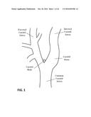 DEVICES AND METHODS FOR TREATING CARDIOVASCULAR AND METABOLIC DISEASE diagram and image