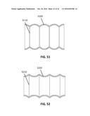 DEVICES AND METHODS FOR TREATING CARDIOVASCULAR AND METABOLIC DISEASE diagram and image