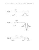 DEVICES AND METHODS FOR TREATING CARDIOVASCULAR AND METABOLIC DISEASE diagram and image