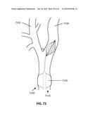 DEVICES AND METHODS FOR TREATING CARDIOVASCULAR AND METABOLIC DISEASE diagram and image