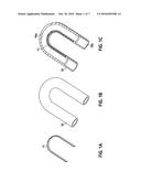 Implantable Curved Shaping Part For Externally Shaping An Implantable     Electrode Line Or A Catheter diagram and image