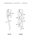 Implantable Curved Shaping Part For Externally Shaping An Implantable     Electrode Line Or A Catheter diagram and image