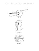 INTEGRATED TOMOGRAPHY - CANCER TREATMENT APPARATUS AND METHOD OF USE     THEREOF diagram and image