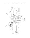 ULTRASONIC SURGICAL INSTRUMENT WITH ARTICULATION JOINT HAVING INTEGRAL     STIFFENING MEMBERS diagram and image