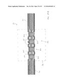 ULTRASONIC SURGICAL INSTRUMENT WITH ARTICULATION JOINT HAVING INTEGRAL     STIFFENING MEMBERS diagram and image