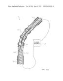 ULTRASONIC SURGICAL INSTRUMENT WITH ARTICULATION JOINT HAVING INTEGRAL     STIFFENING MEMBERS diagram and image