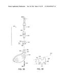 INTERCHANGEABLE SHAFT SYSTEM diagram and image