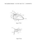 GOLF CLUB HEAD diagram and image