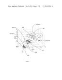 Measurement of Knock Intensity diagram and image