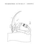 Cam Assembly for use with Pole Climbing Fall Restriction Device diagram and image