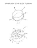 Valvular Closure Element, Closure Cap Comprising The Valvular Closure     Element, And A Method And An Apparatus For Manufacturing The Valvular     Closure Element diagram and image