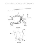 Valvular Closure Element, Closure Cap Comprising The Valvular Closure     Element, And A Method And An Apparatus For Manufacturing The Valvular     Closure Element diagram and image