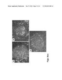 MEDIUM COMPRISING TRANSFORMING GROWTH FACTOR BETA 1 AND BASIC FIBROBLAST     GROWTH FACTOR diagram and image