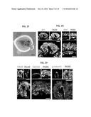 THREE-DIMENSIONAL MODEL OF HUMAN CORTEX diagram and image