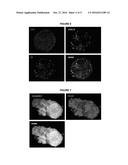 PANCREATIC ISLET-LIKE CELL STRUCTURES AND A METHOD OF PREPARING THEREOF diagram and image