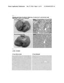 COMPOSITION FOR REGENERATING NORMAL TISSUE FROM FIBROTIC TISSUE diagram and image