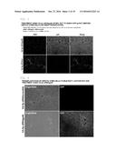 COMPOSITION FOR REGENERATING NORMAL TISSUE FROM FIBROTIC TISSUE diagram and image