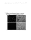 COMPOSITION FOR REGENERATING NORMAL TISSUE FROM FIBROTIC TISSUE diagram and image