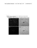 COMPOSITION FOR REGENERATING NORMAL TISSUE FROM FIBROTIC TISSUE diagram and image