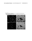 COMPOSITION FOR REGENERATING NORMAL TISSUE FROM FIBROTIC TISSUE diagram and image