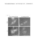 COMPOSITION FOR REGENERATING NORMAL TISSUE FROM FIBROTIC TISSUE diagram and image