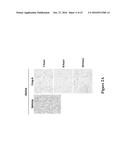 METHODS FOR DETERMINING DRUG EFFICACY FOR THE TREATMENT OF DIFFUSE LARGE     B-CELL LYMPHOMA, MULTIPLE MYELOMA, AND MYELOID CANCERS diagram and image