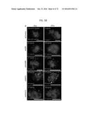 REACTIVATION OF X CHROMOSOME GENES diagram and image