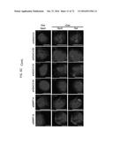 REACTIVATION OF X CHROMOSOME GENES diagram and image