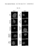 REACTIVATION OF X CHROMOSOME GENES diagram and image