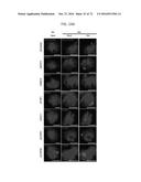 REACTIVATION OF X CHROMOSOME GENES diagram and image