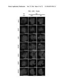 REACTIVATION OF X CHROMOSOME GENES diagram and image