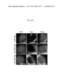 REACTIVATION OF X CHROMOSOME GENES diagram and image