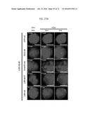 REACTIVATION OF X CHROMOSOME GENES diagram and image