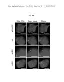 REACTIVATION OF X CHROMOSOME GENES diagram and image