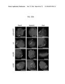 REACTIVATION OF X CHROMOSOME GENES diagram and image