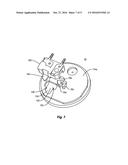 BATTERY ASSEMBLY FOR IMPLANTABLE MEDICAL DEVICE diagram and image